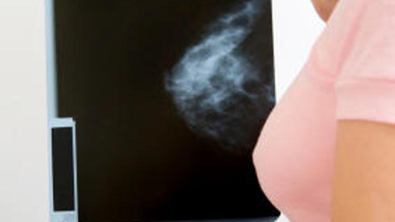 Z novim programom za zgodnejše odkrivanje raka morda lahko pričakujemo manjšo ob