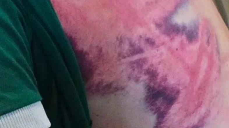 Policijsko nasilje v Srbiji