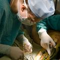 Operacija krčnih žil velja za manj tvegano, pravijo strokovnjaki. (Foto: Shutter