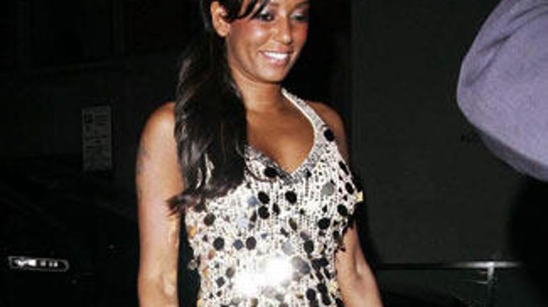 Mel B bo v Magnumu zaigrala detektivko z ostrim jezikom.