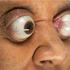 Kim Goodman lahko izbulji očesno zrklo kar 12 milimetrov iz očesa.
