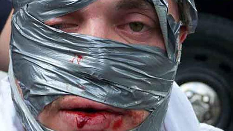 Prelepljen obraz še ne pomeni, da vas ne bodo prepoznali.