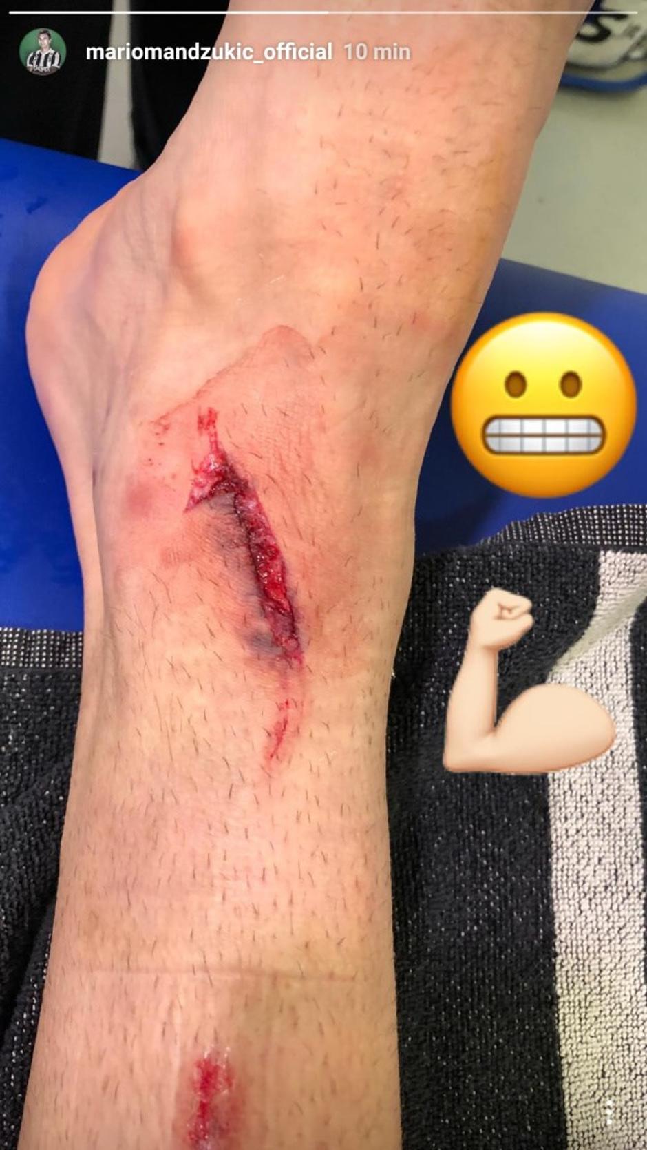 Mandžukić poškodba | Avtor: Instagram
