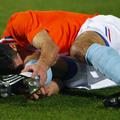 Robin van Persie si je huje poškodoval gležen na prijateljski tekmi z Italijo. (
