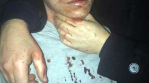 Abdulkadir Masharipov