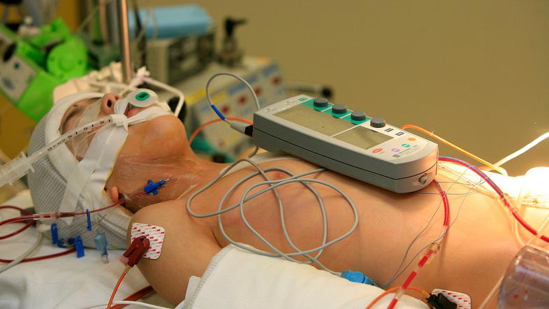 Otroška srčna kirurgija