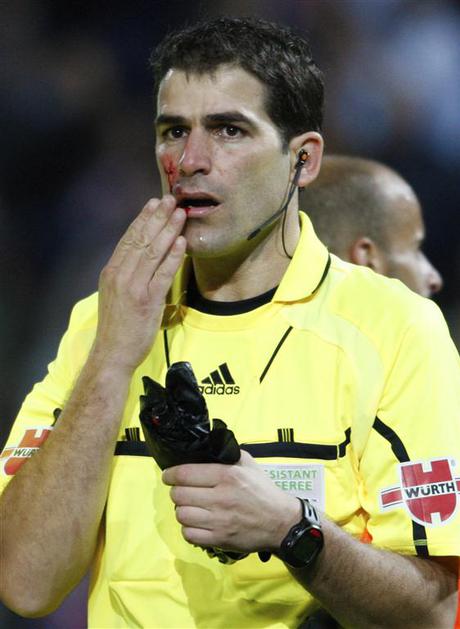 granada sodnik poškodba  Xavier Aguilar Rodríguez