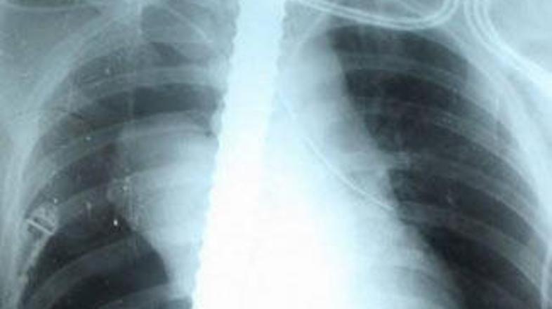 Dežurna zdravnica si je morala prižgati cigareto, da se je umirila, saj ni mogla