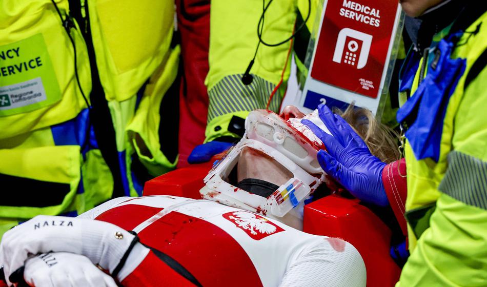 Grozljiv padec na OI, okrvavljeno Poljakinjo na nosilih odnesli iz dvorane