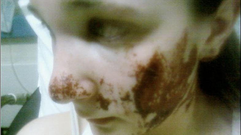 Day je Sarah močno poškodoval. (Foto: thesun.co.uk)