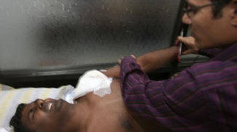 Ranjeni pripadnik obmejnih varnostnih sil