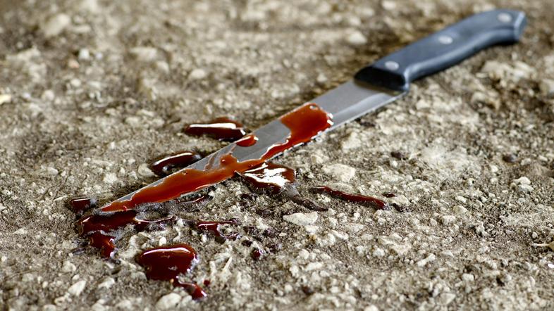 Krvav nož (slika je simbolična)