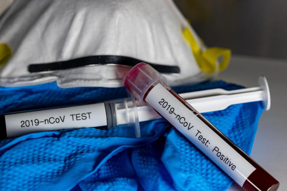 Covid-19 | Avtor: Profimedia