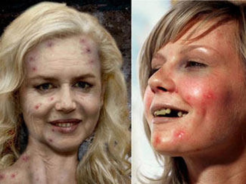 Tudi zvezdniki so lahko grdi.