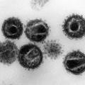Z elektronskim mikroskopom 240.000-krat povečana slika virusa HIV, povzročitelja