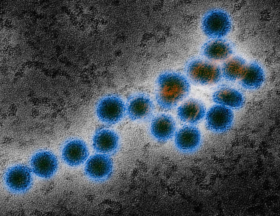 Virus Zahodnega Nila | Avtor: Profimedia