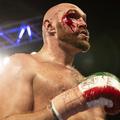 tyson fury