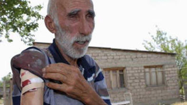 Domačin kaže posledice sobotnega obstreljevanja.