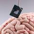 Neuralink možgani čip