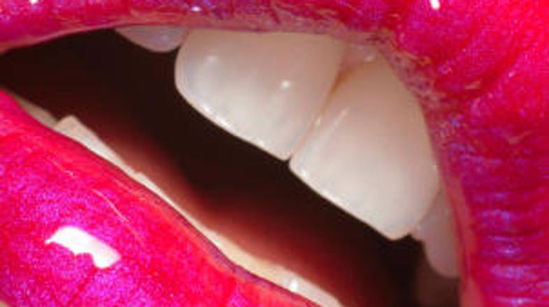 Občutljiv ustni predel dlesni lahko o vas pove marsikaj.