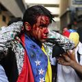 Venezuela, protestnik
