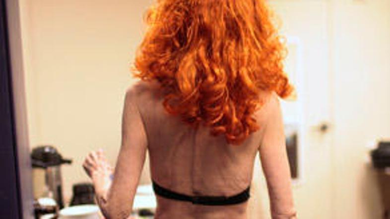 Nekoč se je bala, da ima prevelike.