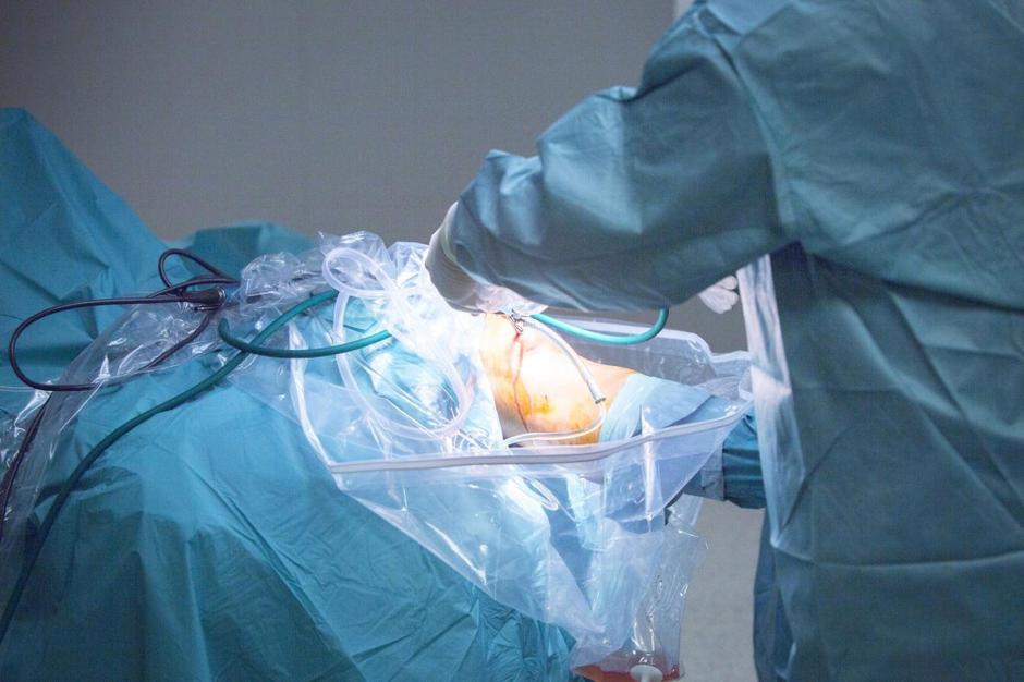 Artroskopija kolena | Avtor: Profimedias