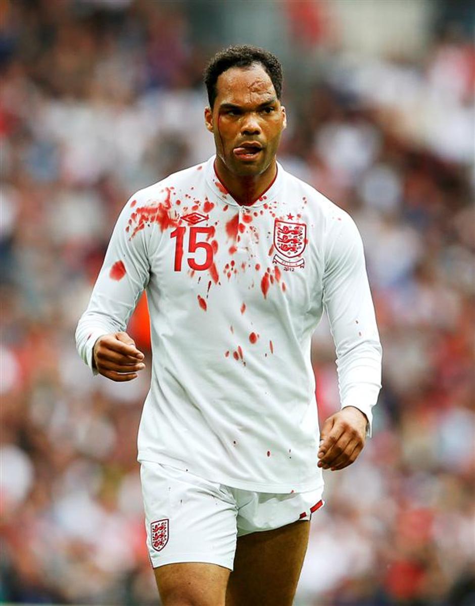 Lescott kri krvavenje Anglija Belgija prijateljska tekma Wembley | Avtor: EPA