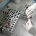 Laboratorij HIV AIDS epruvete iStock