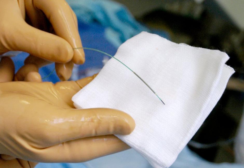 Žilne opornice | Avtor: Profimedias