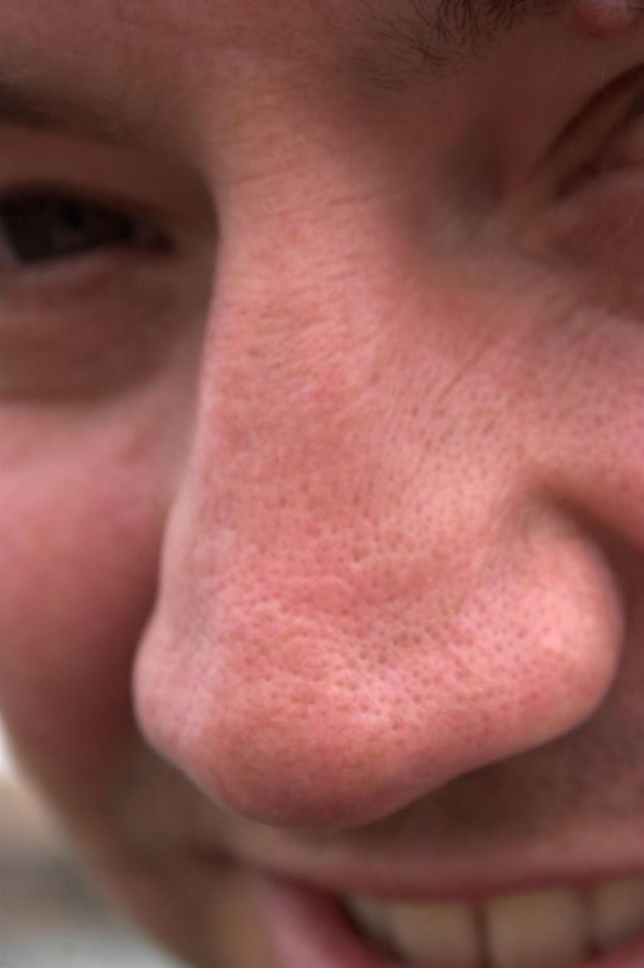 Nos | Avtor: Profimedias