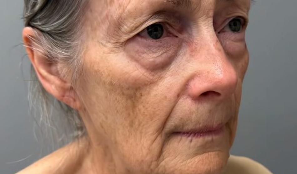 Video: Plastični kirurg 70-letnico pomladil za tri desetletja!