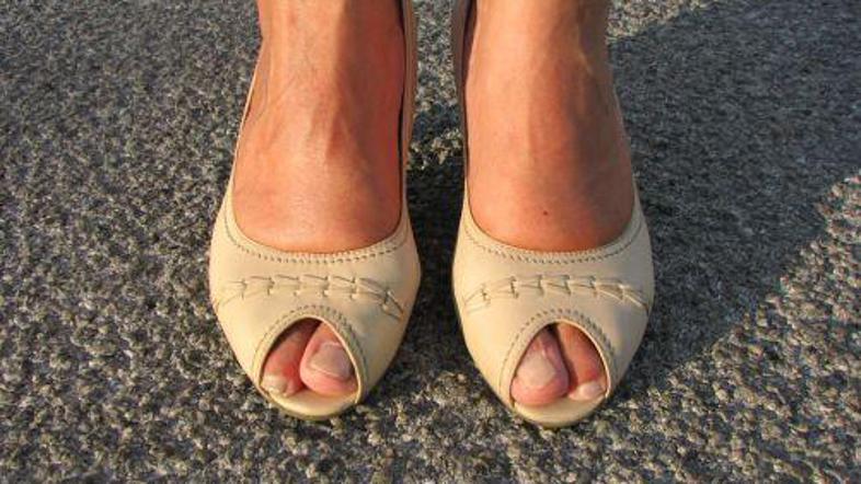 Štrleča kost modificira obliko usnjenega čevlja.