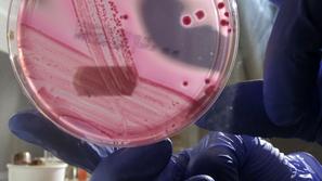 Američani so prepričani, da so superbakterijo vzgojili v laboratoriju in jo name