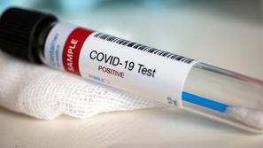 Pozitiven covid-19 test
