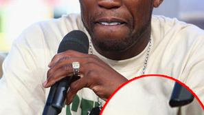Roke 50 Centa so brazgotinaste zaradi laserskega odstranjevanja tetovaž. 