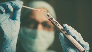 Covid-19, testiranje