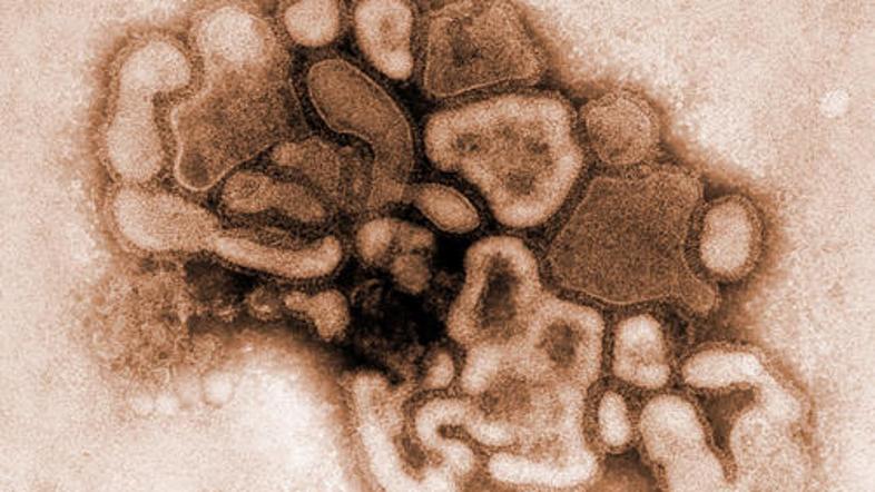 Virus influence H1N1