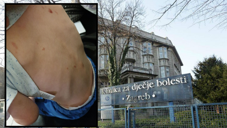 Zlorabljanje dečka v Zagrebu