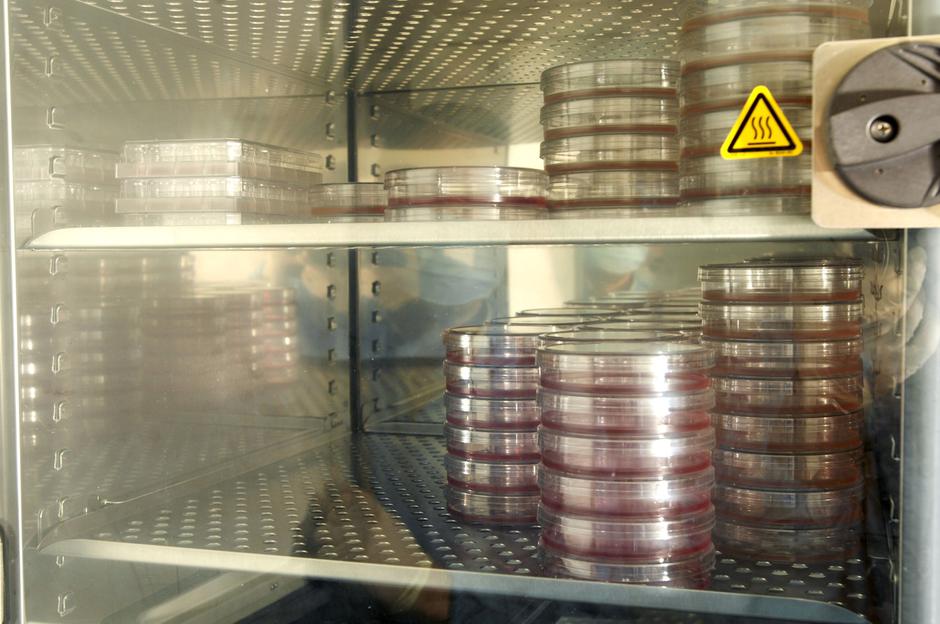 ohlajene matične celice pred zamrznitvijo | Avtor: Profimedia