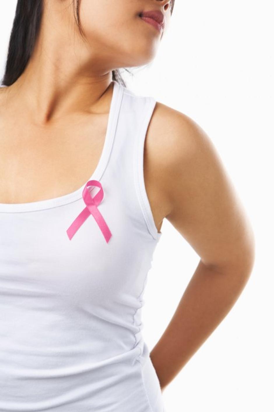 rak dojke, ženska | Avtor: Shutterstock