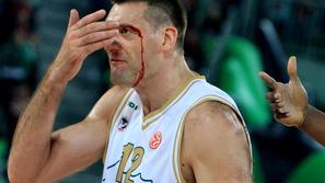 Goran Jagodnik je s krvjo zaradi prebite arkade "oplemenitil" zmago. (Foto: Nik 