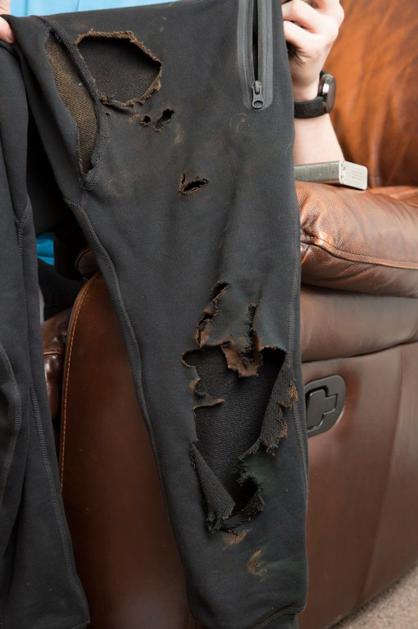 elektronska cigareta eksplozija