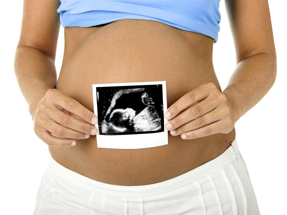 nosečnost, nosečnica, ultrazvok | Avtor: Žurnal24 main