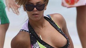 Kuku, bradavička je tu! (Foto: Pop Crunch)