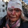 Ukrajinka, ranjena v eksploziji