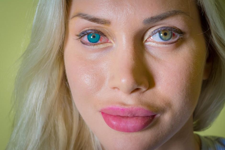 Pixee Fox | Avtor: Profimedias