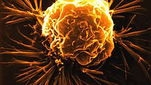 Po zadnjih dostopnih podatkih registra raka na onkološkem inštitutu je v letu 20