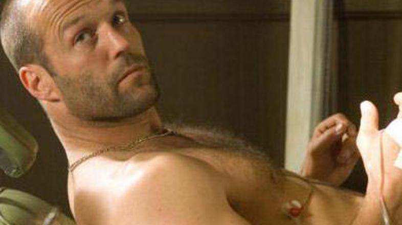 Kako privlačen bi bil šele z lasmi ...