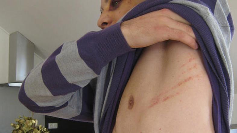 B. B. so v bolnišnico odpeljali prijatelji, kjer je tri dni ležal na travmatološ